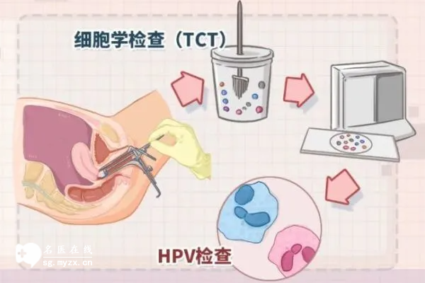 为什么不想做HPV和TCT检查? 3个原因揭秘