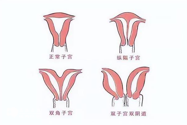 完全纵膈子宫怀孕经验大公开！告别终止妊娠实现怀孕梦想