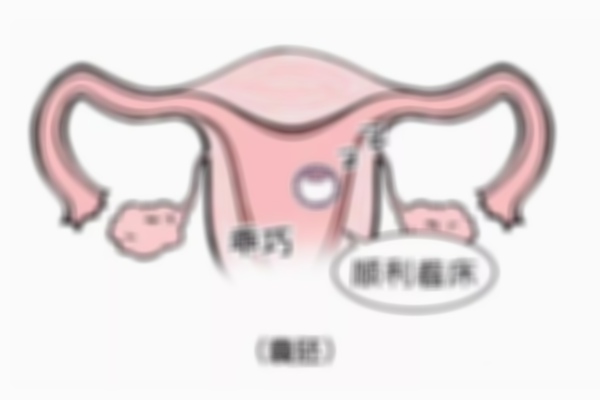 详解鲜胚移植失败后要刮宫的必要性，提高着床成功率的主要原因！