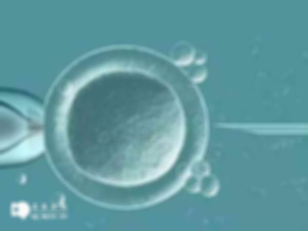 赴俄罗斯做试管婴儿有什么要求吗？证件要求和注意事项解析