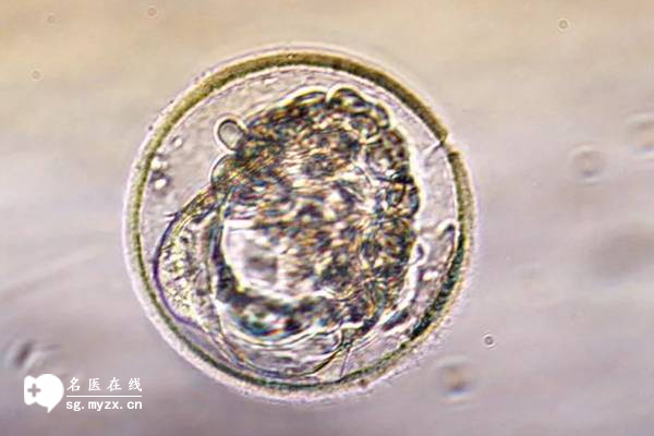 冻囊胚自然周期移植时要如何正确用药？用药的方式分享