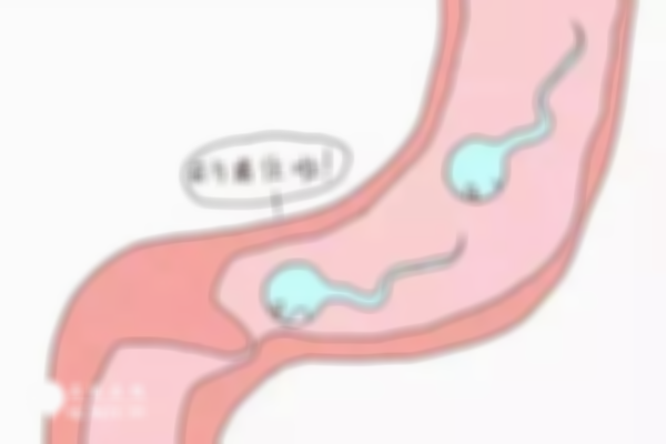 输卵管堵塞患者的备孕攻略：在疏通与试管进行选择！