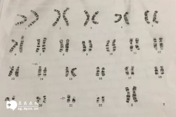 试管染色体报告需要关注有效期，超过期限要重新检查！