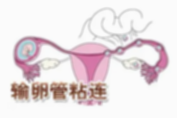 盆腔粘连患者不要直接做试管婴儿！先进行手术分粘恢复子宫功能