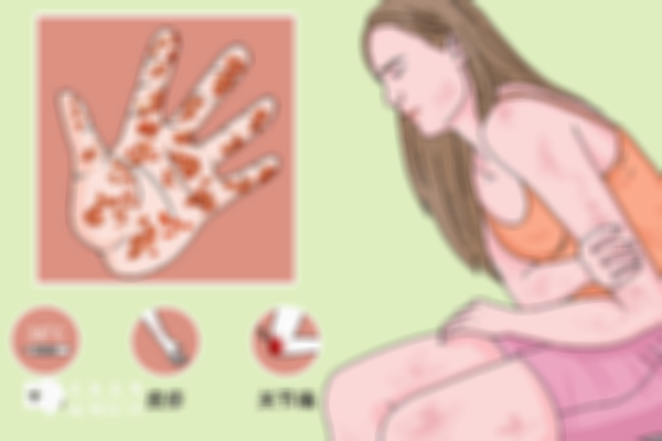 来看看自测梅毒的方式有哪些？只需要看这五个方面就行