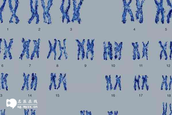 14号染色体异常会带来哪些影响，智力障碍、前列腺癌都是这导致的