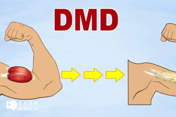 有dmd基因也可以做试管，三代试管技术可筛查遗传病