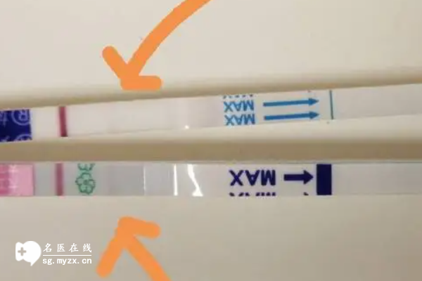 冻胚移植第六天测出大白板别焦虑，出现这些症状可能是着床了