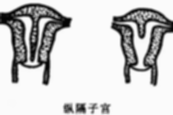 3分钟了解影响子宫纵隔试管成功率的原因，所有答案都在这里