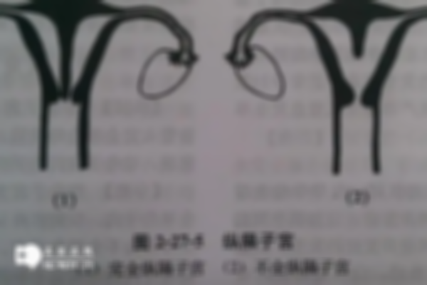 子宫畸形还能不能做试管怀孕？快速了解不同类型的成功率