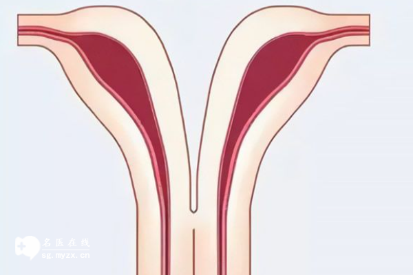 并不是所有子宫畸形都能做试管，先达到这些条件再说