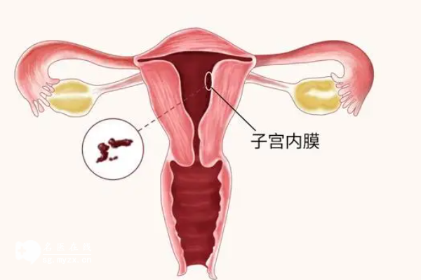 子宫内膜a10可不可以移植？看完这篇文章就能知晓