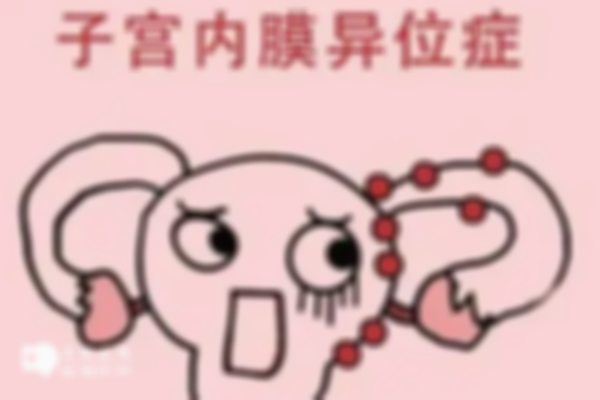 子宫内膜异位症选择哪种试管方案好？看看这两种哪个更适合你