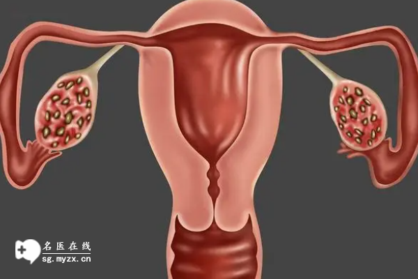 性激素六项都有哪些指标？与多囊之间的关系要清楚