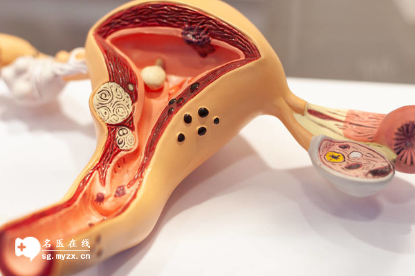 双侧巧囊能否做试管主要看囊肿大小