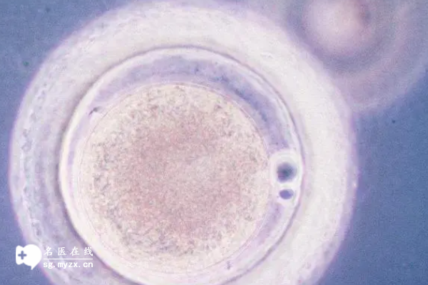 囊胚移植后早上测出怀孕下午出现白板怎么回事？原因竟是这