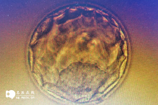 移植时内膜厚度13mm也可以做，着床与否还有希望