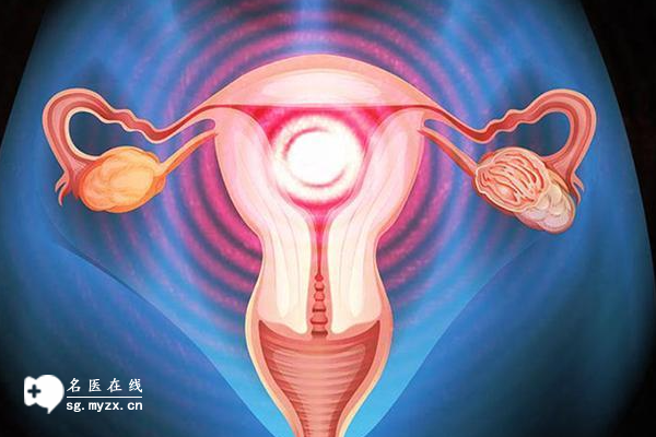 子宫内膜异位症不除影响试管，两大方法助你成功