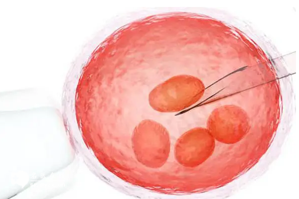 一文说清CCRM生殖医学中心做试管的全流程