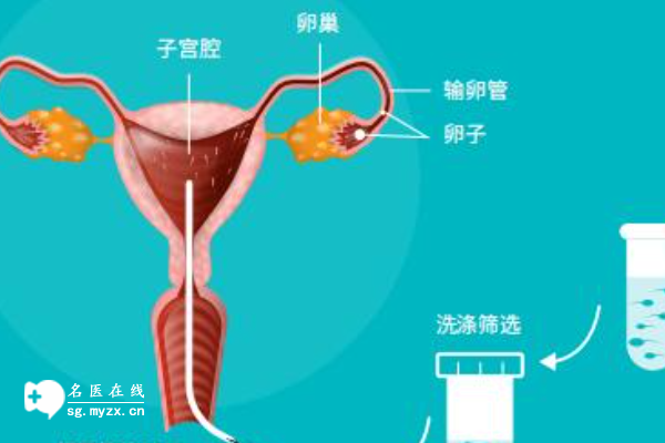 2024国内三代试管婴儿流程分为3步，请仔细看好了！