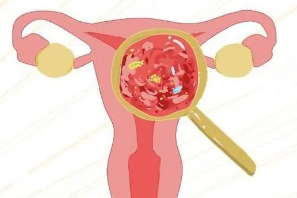 重度宫腔粘连12分做试管能成功吗？教你提高成功率方法