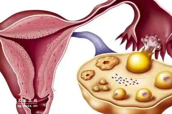 卵巢囊肿试管前穿刺原因揭秘：了解后更安心