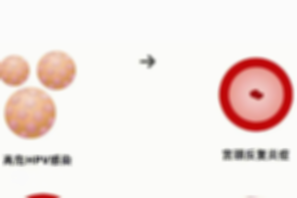 HPV阳性会影响试管成功率吗？试管风险提前知晓