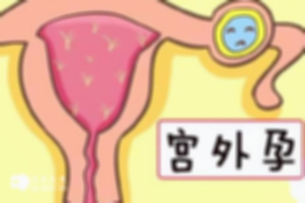 宫外孕如何避免？切除输卵管的女性更该注意