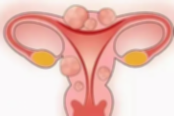 女性患有卵巢囊肿，做一代试管大概需6-8周时间