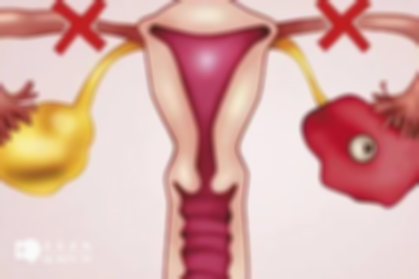 达菲林可缓解子宫内膜异位症吗？使用禁忌需注意