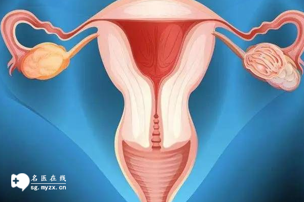 双角子宫与纵隔子宫：区别深度解析