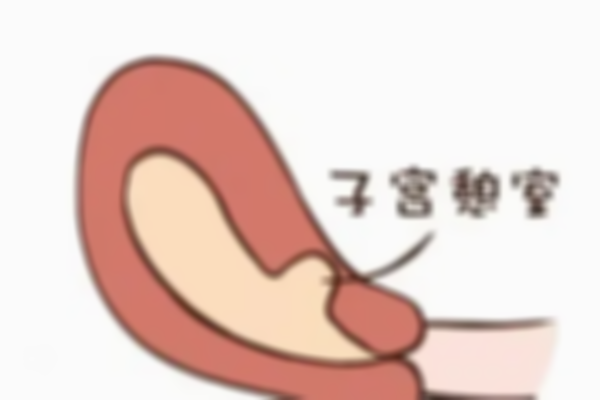 子宫疤痕憩室怀孕应对：两种治疗方法先码住！