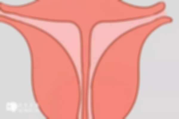 女性做完子宫纵隔手术后，能否移植双胎需评估！