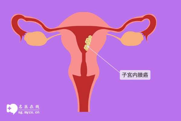 女性子宫内膜受损还能生育吗？试管婴儿或是最佳选择