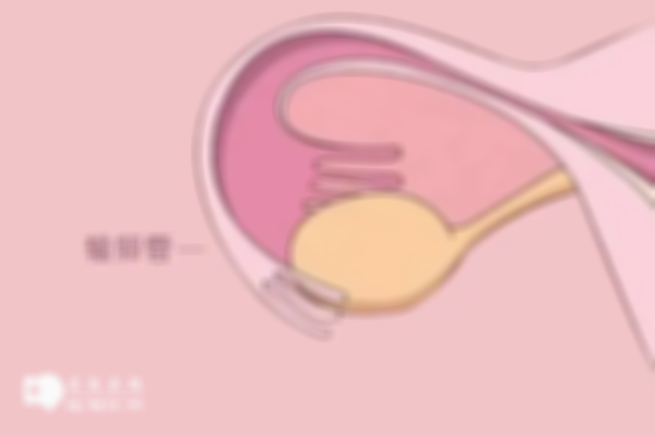 探究！输卵管切除后原理解读，附成功率、影响因素及风险一览