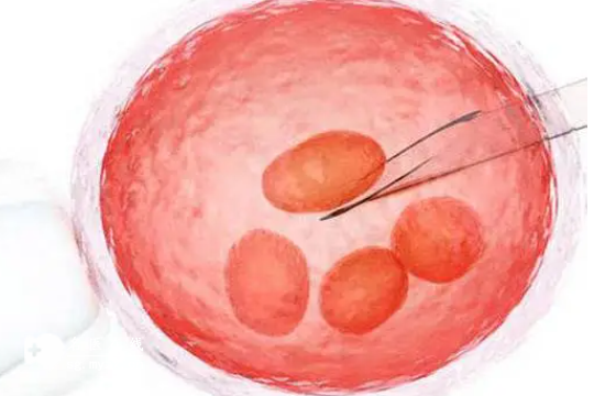 深度解析！试管卵子质量不佳与方案选择的关联，必读