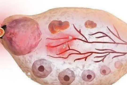 卵巢萎缩还能做试管生育吗？医生：评估身体条件很重要