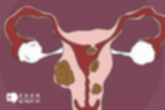 子宫腺肌症做试管有哪些影响，成功率降低不可避免