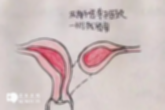 子宫不全纵膈做一次试管婴儿要花多少钱？具体费用包括这几种！