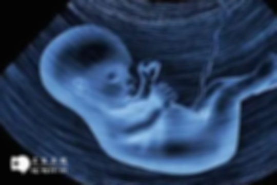 怀孕超过32周了还能去医院做小排畸吗？医生建议10到14周之间进行