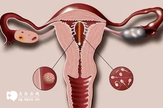 子宫萎缩能否人工受孕需评估，专业医生为你保驾护航