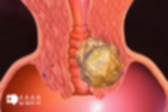 患有宫颈炎对做试管的影响解读，着床困难是主要风险