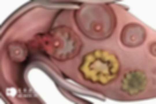 卵泡萎缩做试管婴儿还有希望吗？听听医生怎么说