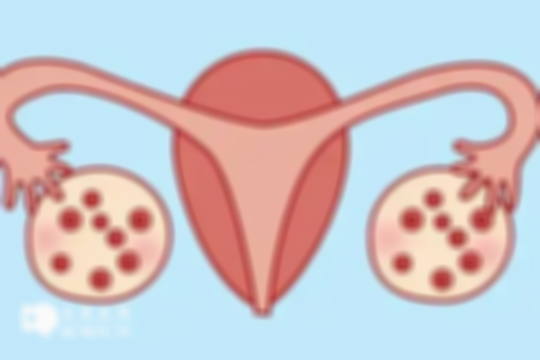 女性患有多囊卵巢仍可怀孕，怎么调理看这里