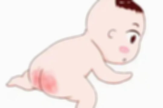 宝宝红屁屁的真实原因大揭秘，这样护理更健康