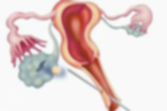女性患排卵障碍的“真凶”竟是它们，看完及早预防