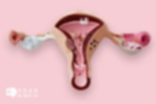 子宫腺肌症患者可以做卷腹运动吗？坚持做这3项运动可缓解