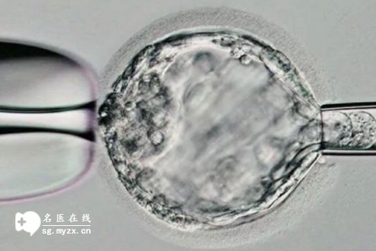 济南找私立机构做三代试管婴儿的费用公开，来看收费标准