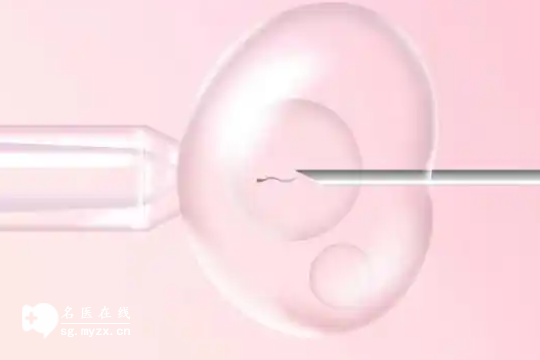 长沙做试管婴儿的价格预算，1分钟看完各项收费