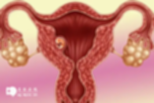女性弓形子宫会影响怀孕吗？分享3招有效助孕